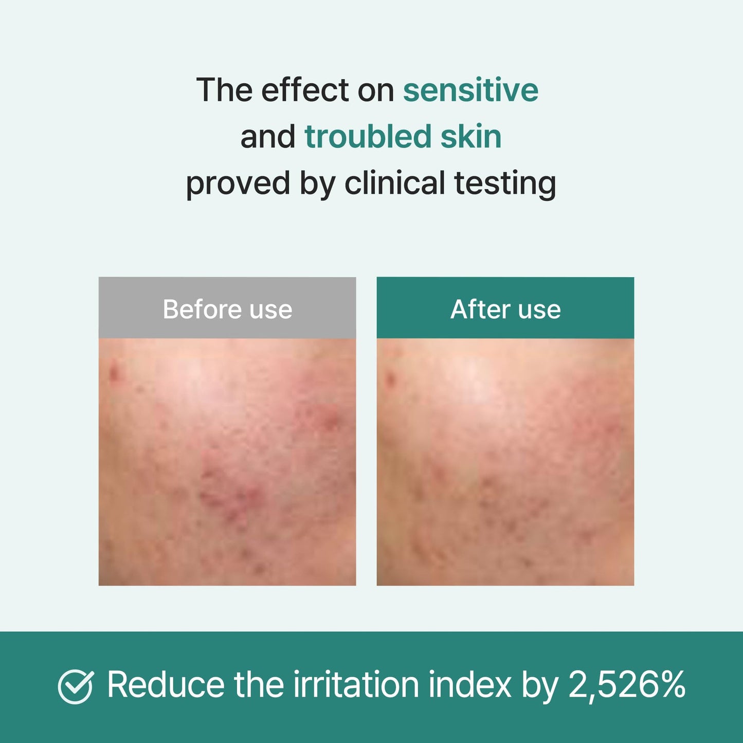 I'm from Licorice Calming Cream 50 ml, Korean Licorice, Soothing, Hydrating for Sensitive & Irritated Skin